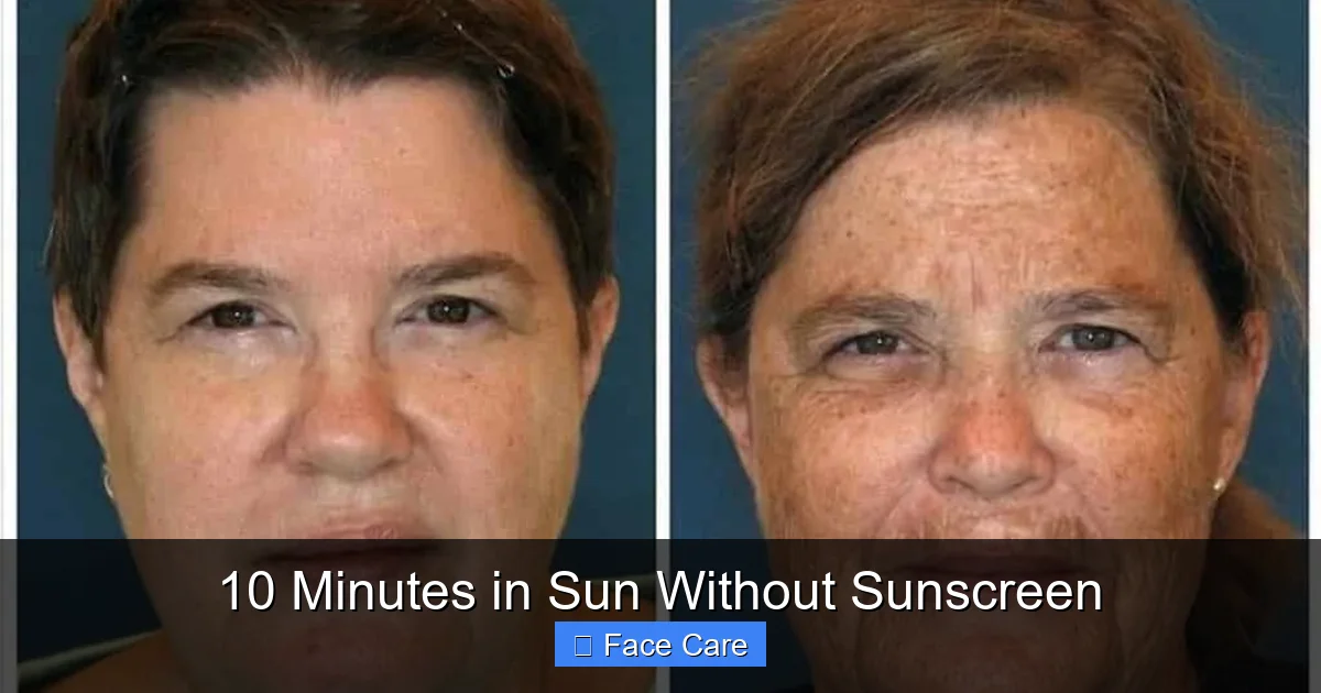 10 Minutes in Sun Without Sunscreen