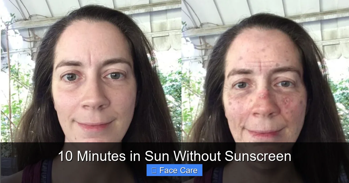 10 Minutes in Sun Without Sunscreen
