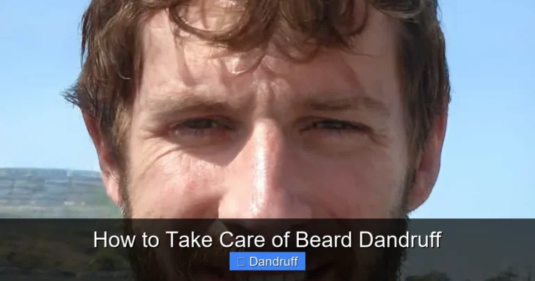 How to Take Care of Beard Dandruff