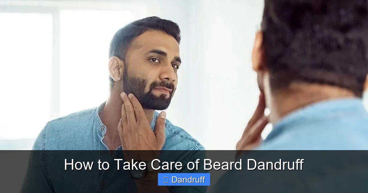 How to Take Care of Beard Dandruff