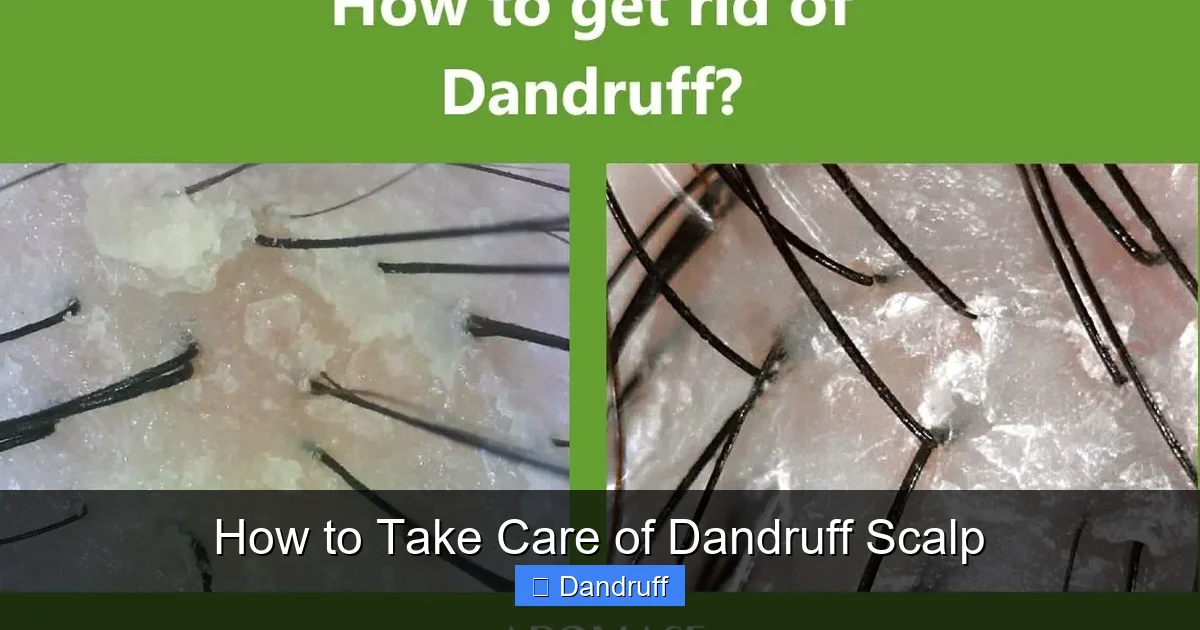 How to Take Care of Dandruff Scalp